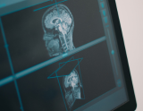Stimulation cérébrale non invasive : nouvelles pistes autour de la dopamine